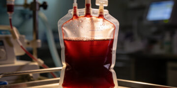Sala de donación de sangre de luz cálida con bolsas de plasma vacías colgando en una clínica de La Paz.